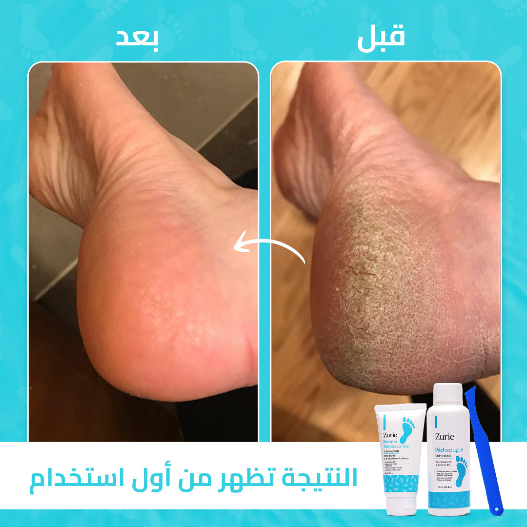 مجموعة العناية بالأقدام Zurie