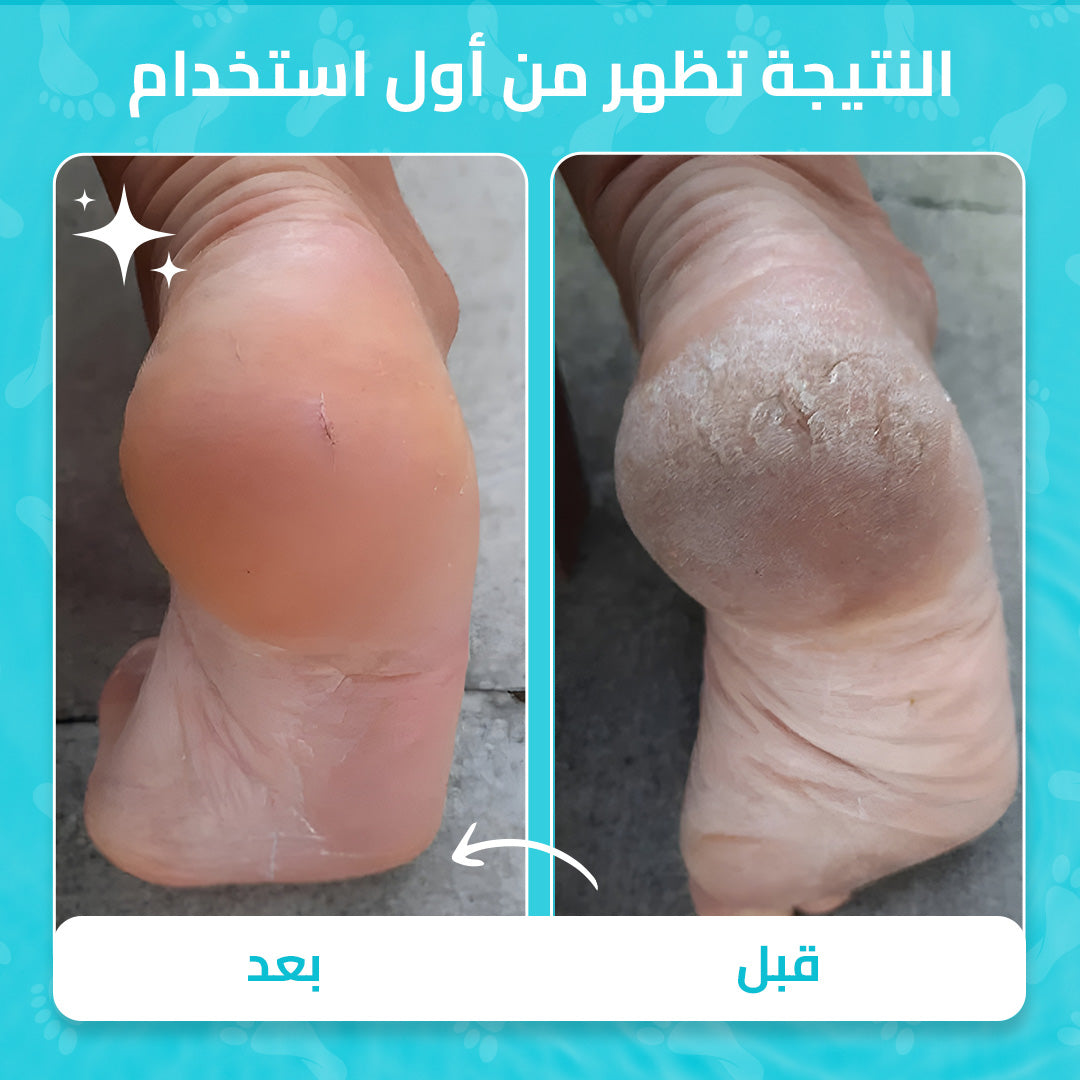 مجموعة العناية بالأقدام Zurie
