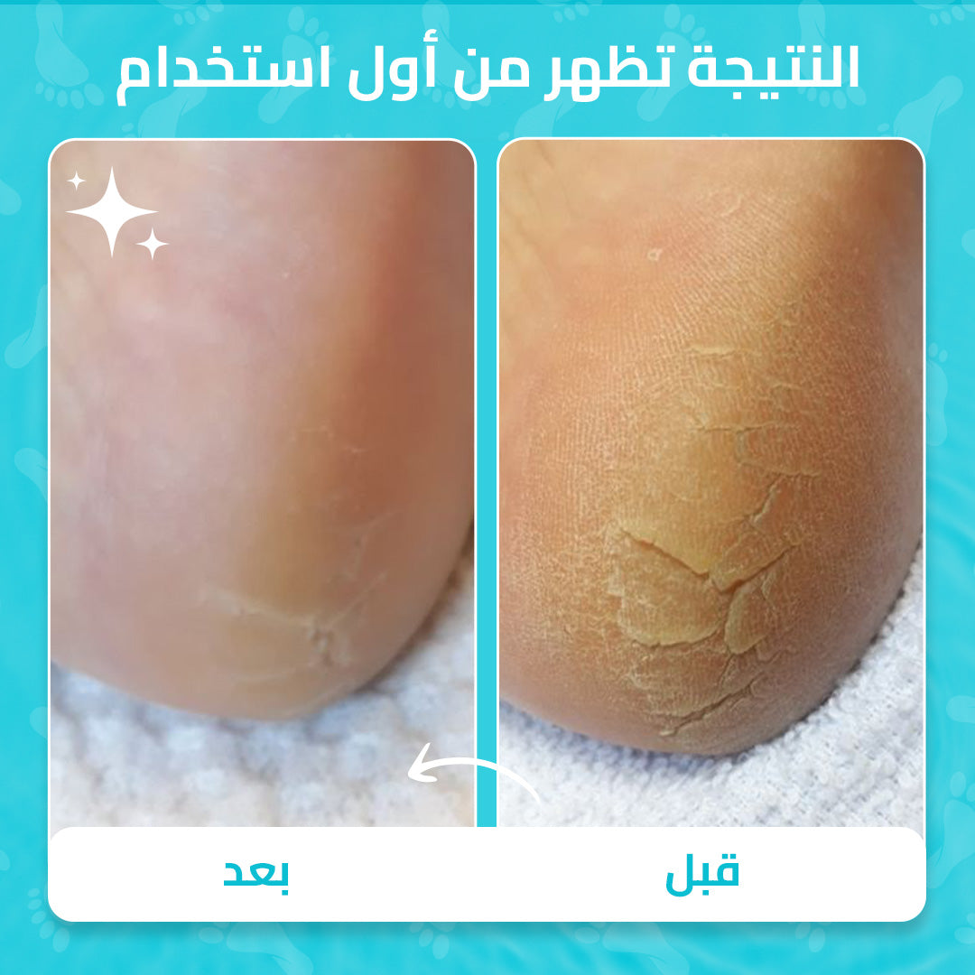 مجموعة العناية بالأقدام Zurie
