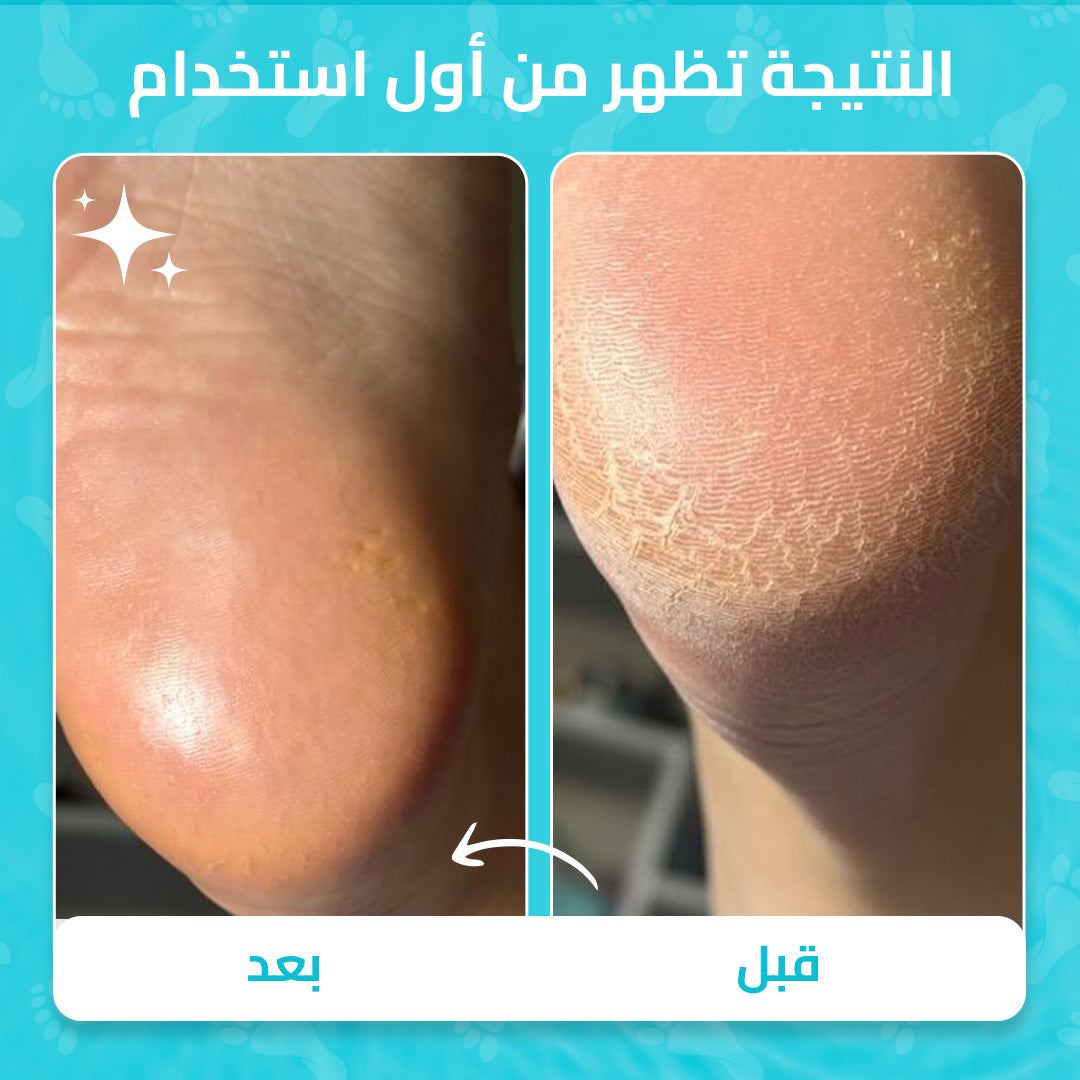مجموعة العناية بالأقدام Zurie